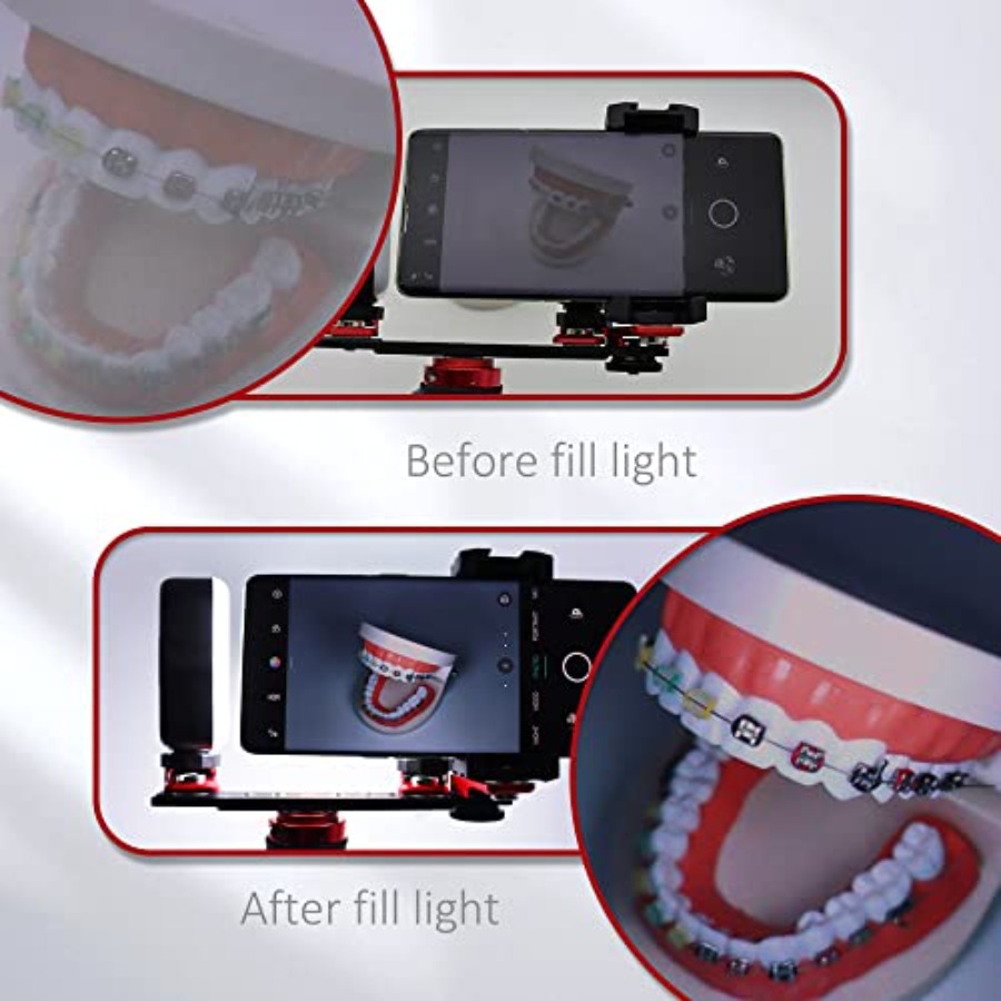 Bluetooth Dental Flash Light P – Photography Equipment recenzja i cena