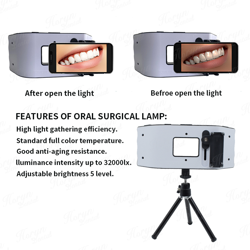 Dental Flash Light Photography – Photography Equipment recenzja i cena